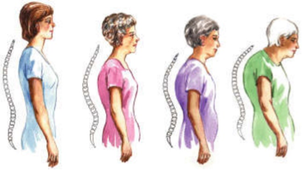 posture